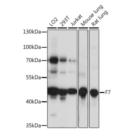 Western Blot - Anti-Factor VII Antibody (A90049) - Antibodies.com