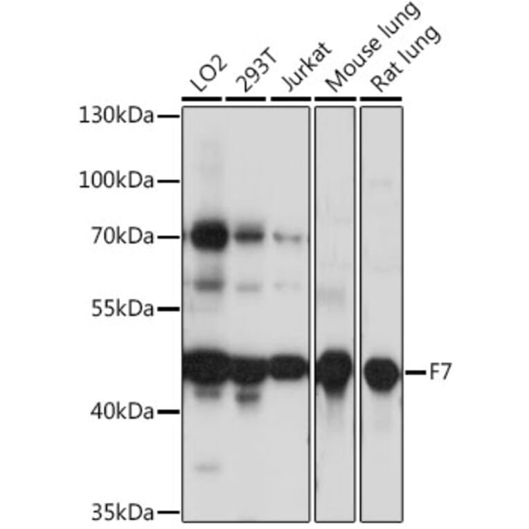 Western Blot - Anti-Factor VII Antibody (A90049) - Antibodies.com