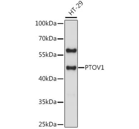 Western Blot - Anti-PTOV1 Antibody (A90050) - Antibodies.com