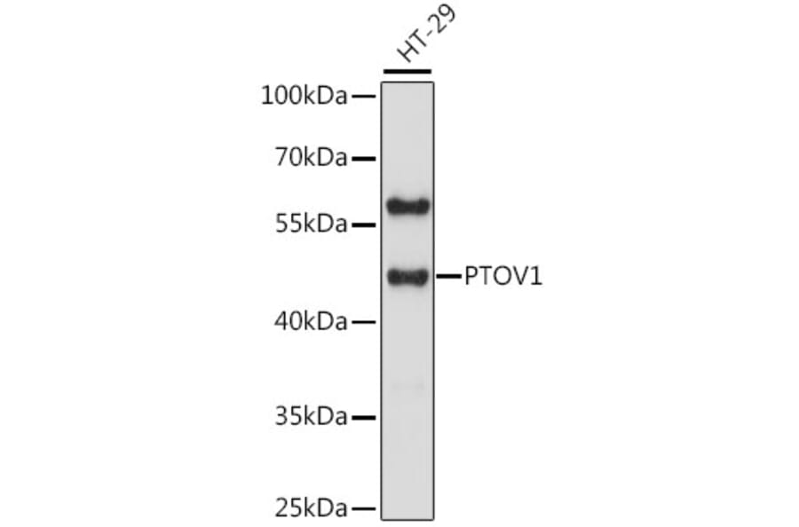 Western Blot - Anti-PTOV1 Antibody (A90050) - Antibodies.com