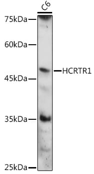 Western blot analysis of extracts of various cell lines, using Anti-HCRTR1 Antibody (A14740) at 1:1,000 dilution.
Secondary antibody: Goat Anti-Rabbit IgG (H+L) (HRP) (AS014) at 1:10,000 dilution.
Lysates / proteins: 25µg per lane.
Blocking buffer: 3% non-fat dry milk in TBST.
Detection: ECL Basic Kit (RM00020).
Exposure time: 15s.