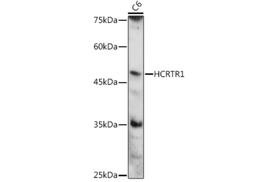 Western Blot - Anti-Orexin Receptor 1/Ox-1-R Antibody (A90051) - Antibodies.com