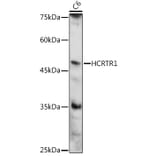 Western Blot - Anti-Orexin Receptor 1/Ox-1-R Antibody (A90051) - Antibodies.com