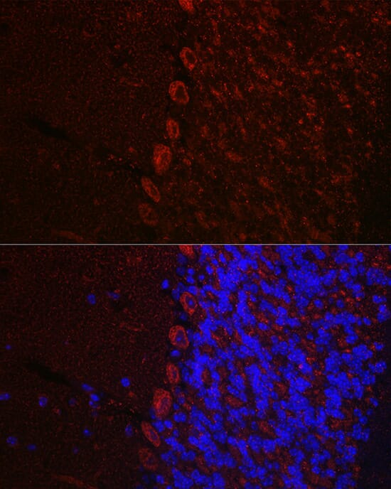 Immunofluorescence analysis of rat brain using Anti-HCRTR1 Antibody (A14740) at dilution of 1:100. Blue: DAPI for nuclear staining.