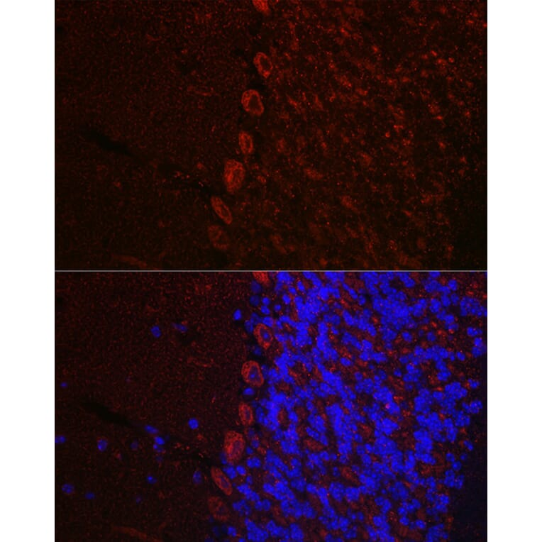 Immunofluorescence - Anti-Orexin Receptor 1/Ox-1-R Antibody (A90051) - Antibodies.com