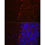Immunofluorescence - Anti-Orexin Receptor 1/Ox-1-R Antibody (A90051) - Antibodies.com