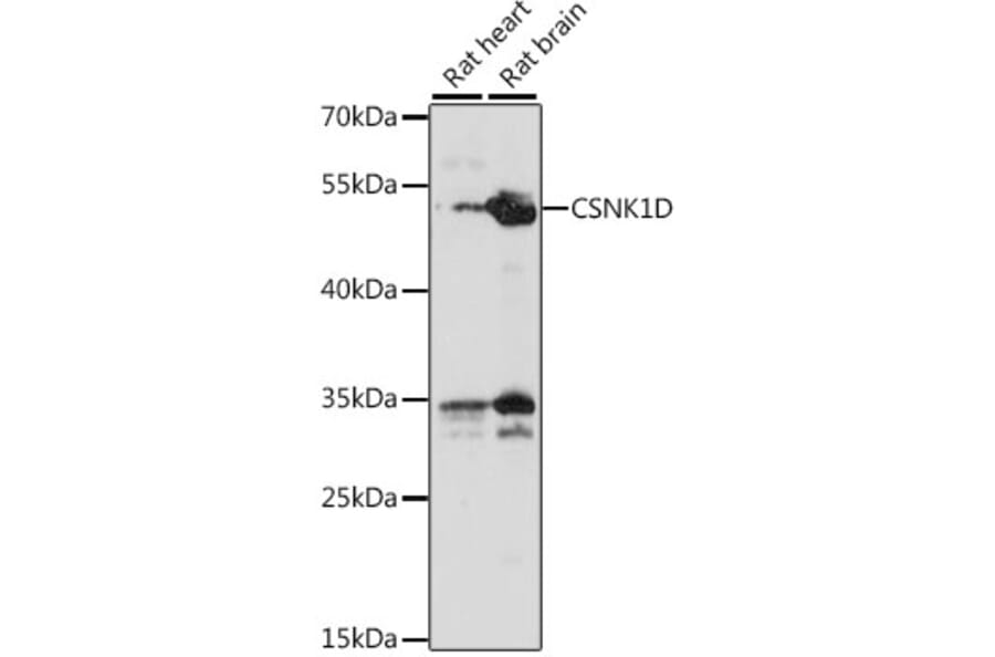 Western Blot - Anti-Casein Kinase 1 delta/CSNK1D Antibody (A90052) - Antibodies.com