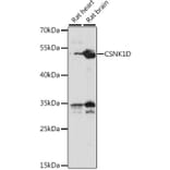 Western Blot - Anti-Casein Kinase 1 delta/CSNK1D Antibody (A90052) - Antibodies.com