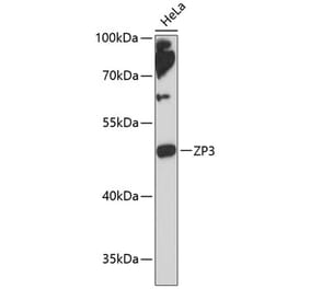 Western Blot - Anti-ZP3 Antibody (A90053) - Antibodies.com