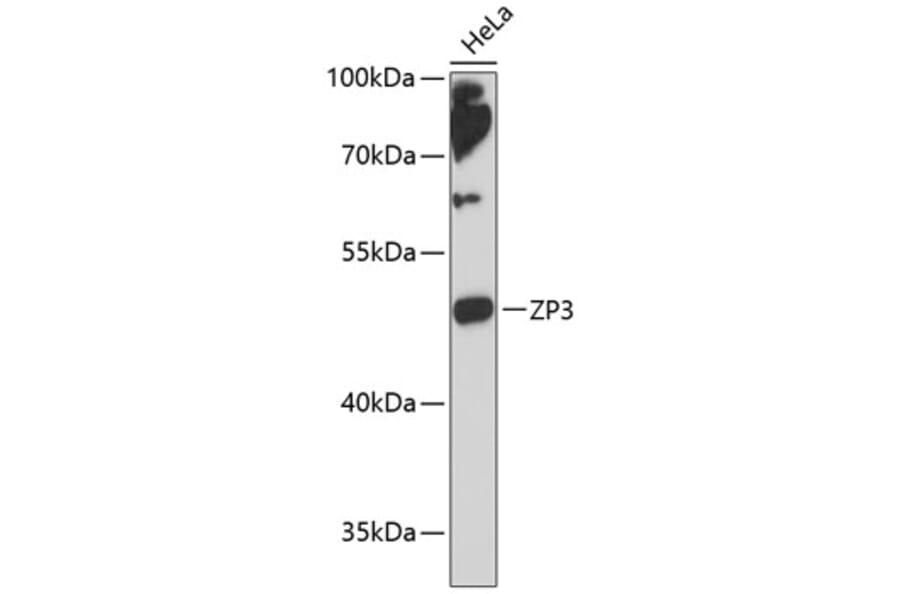 Western Blot - Anti-ZP3 Antibody (A90053) - Antibodies.com