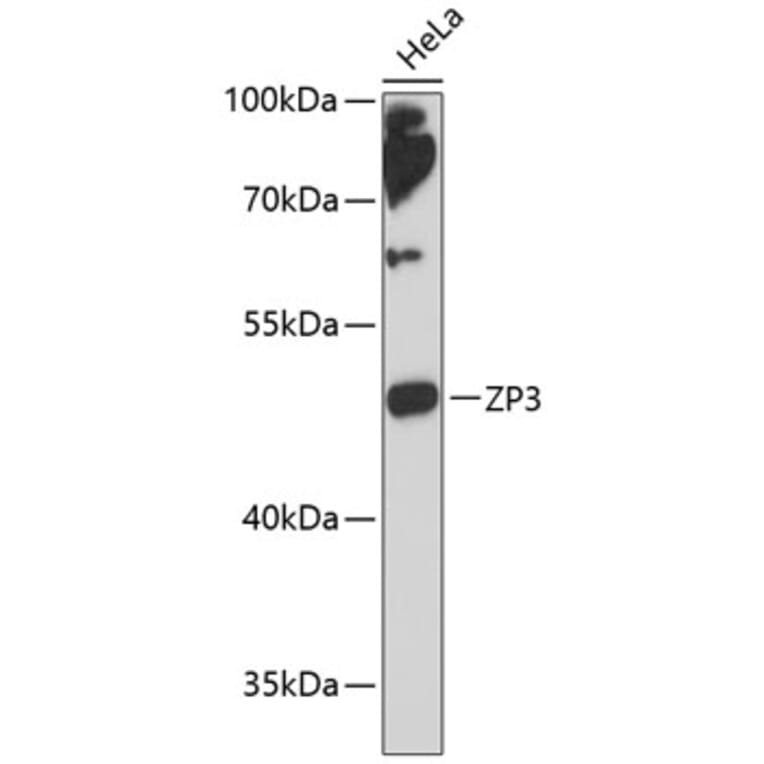 Western Blot - Anti-ZP3 Antibody (A90053) - Antibodies.com