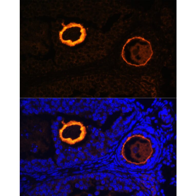 Immunofluorescence - Anti-ZP3 Antibody (A90053) - Antibodies.com