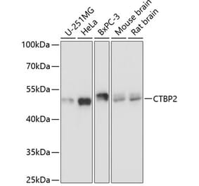 Western Blot - Anti-CTBP2 Antibody (A90054) - Antibodies.com