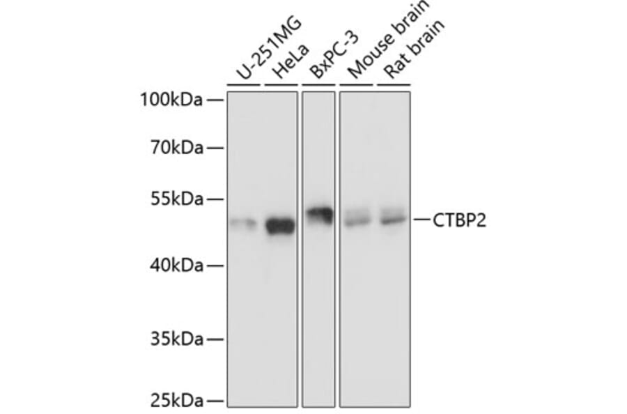 Western Blot - Anti-CTBP2 Antibody (A90054) - Antibodies.com