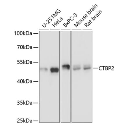Western Blot - Anti-CTBP2 Antibody (A90054) - Antibodies.com