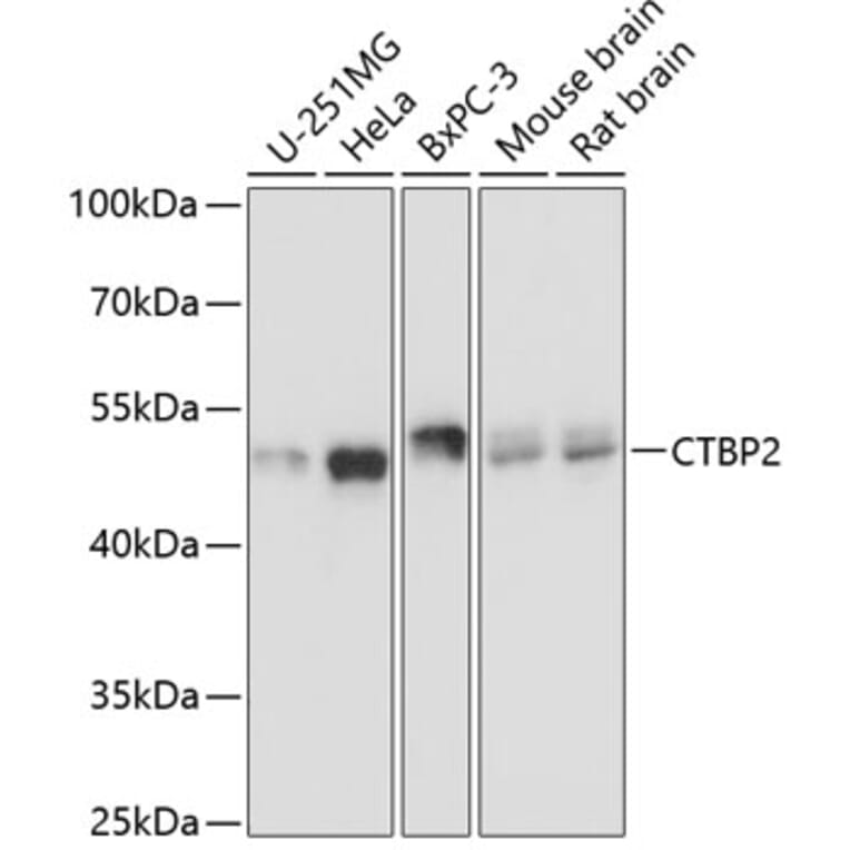 Western Blot - Anti-CTBP2 Antibody (A90054) - Antibodies.com