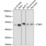 Western Blot - Anti-CTBP2 Antibody (A90054) - Antibodies.com