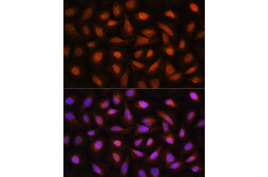 Immunofluorescence - Anti-CTBP2 Antibody (A90054) - Antibodies.com