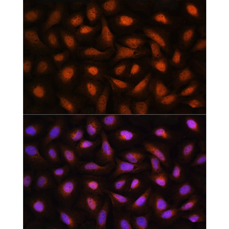 Immunofluorescence - Anti-CTBP2 Antibody (A90054) - Antibodies.com