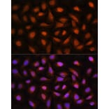 Immunofluorescence - Anti-CTBP2 Antibody (A90054) - Antibodies.com