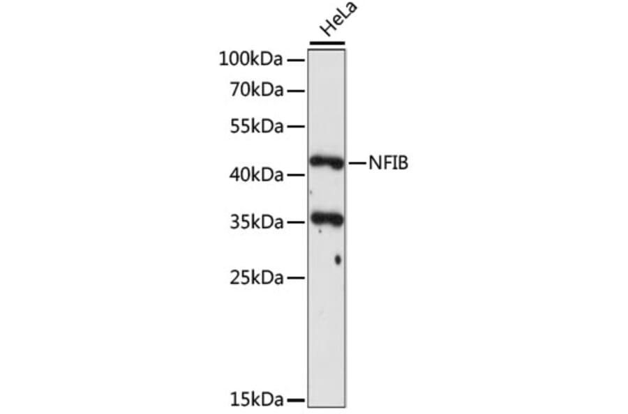 Western Blot - Anti-NFIB/NF1B2 Antibody (A90055) - Antibodies.com