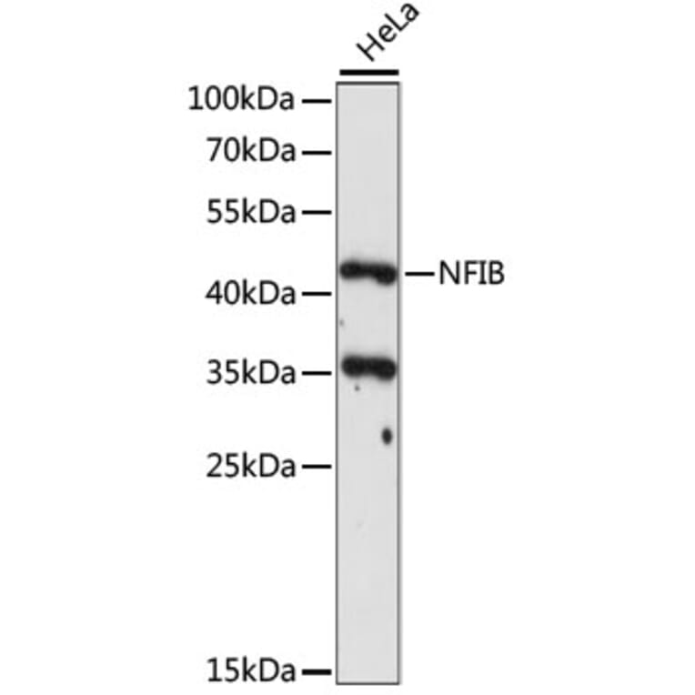 Western Blot - Anti-NFIB/NF1B2 Antibody (A90055) - Antibodies.com