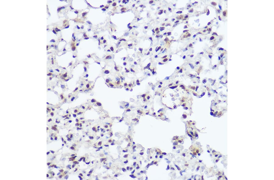 Immunohistochemistry - Anti-NFIB/NF1B2 Antibody (A90055) - Antibodies.com