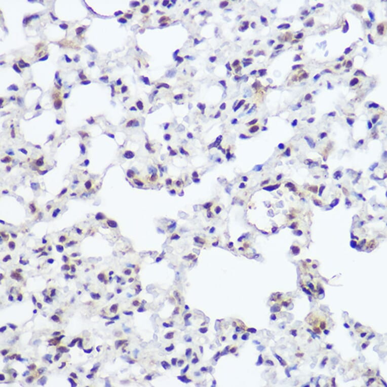 Immunohistochemistry - Anti-NFIB/NF1B2 Antibody (A90055) - Antibodies.com