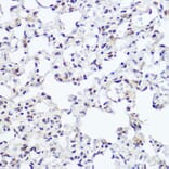 Immunohistochemistry - Anti-NFIB/NF1B2 Antibody (A90055) - Antibodies.com