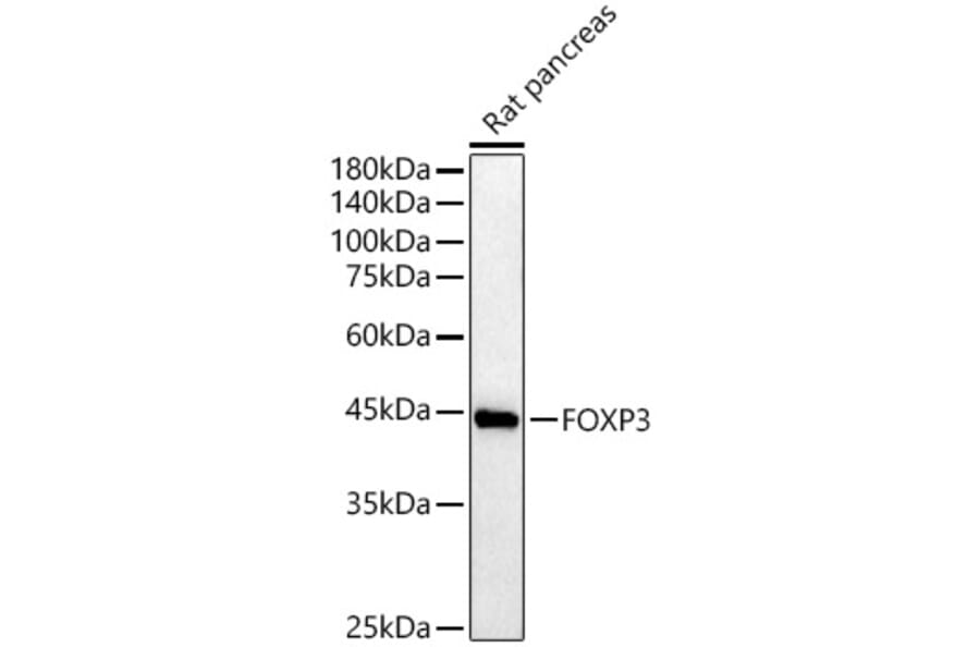 Western Blot - Anti-FOXP3 Antibody (A90056) - Antibodies.com