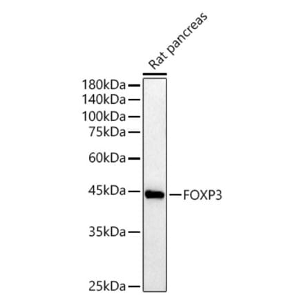 Western Blot - Anti-FOXP3 Antibody (A90056) - Antibodies.com