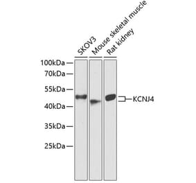 Western Blot - Anti-KCNJ4 Antibody (A90057) - Antibodies.com