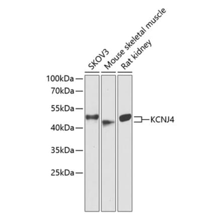 Western Blot - Anti-KCNJ4 Antibody (A90057) - Antibodies.com