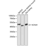 Western Blot - Anti-KCNJ4 Antibody (A90057) - Antibodies.com