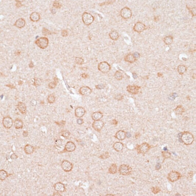 Immunohistochemistry - Anti-KCNJ4 Antibody (A90057) - Antibodies.com