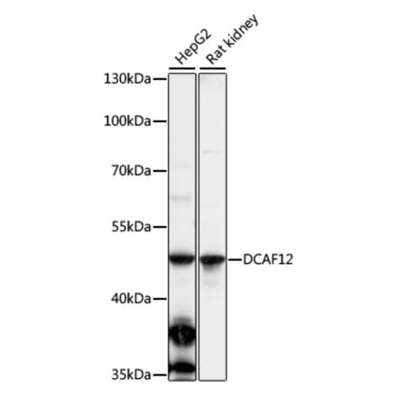 Western Blot - Anti-DCAF12 Antibody (A90058) - Antibodies.com