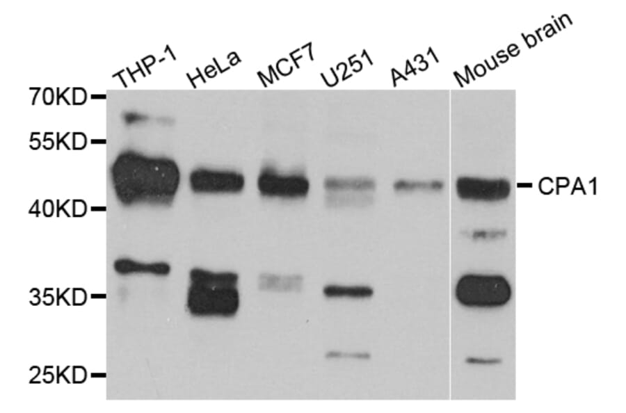 Western Blot - Anti-CPA1 Antibody (A13916) - Antibodies.com