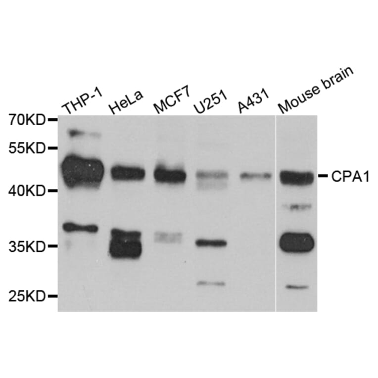 Western Blot - Anti-CPA1 Antibody (A13916) - Antibodies.com