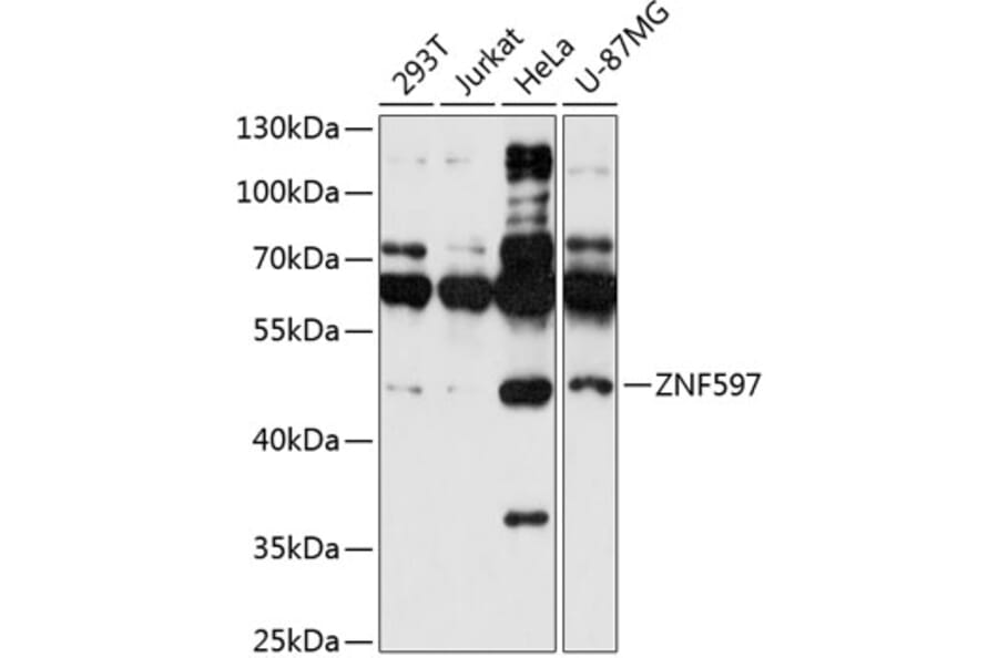 Western Blot - Anti-ZNF597 Antibody (A90061) - Antibodies.com