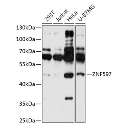 Western Blot - Anti-ZNF597 Antibody (A90061) - Antibodies.com