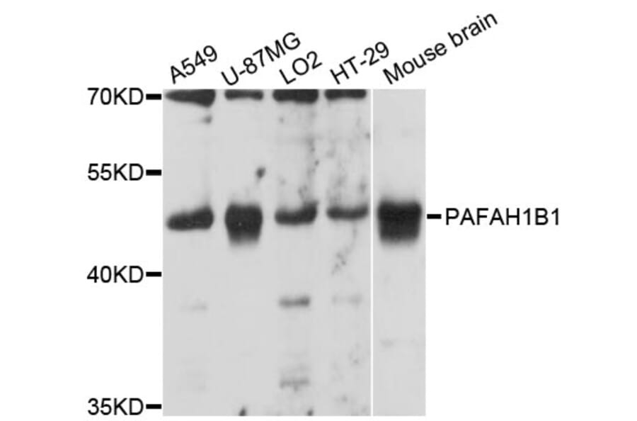 Western Blot - Anti-PAFAH1B1 Antibody (A12643) - Antibodies.com