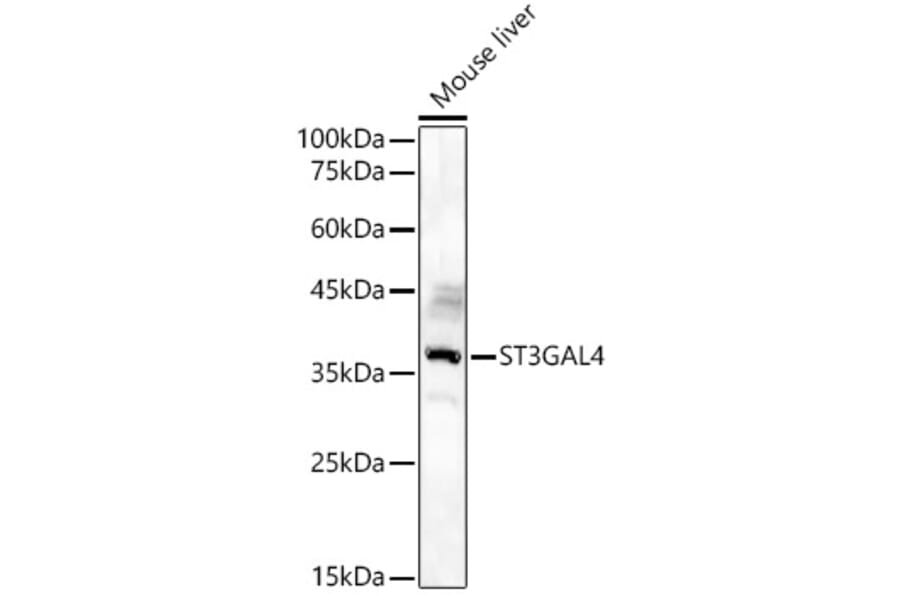 Western Blot - Anti-ST3GAL4 / STZ Antibody (A90064) - Antibodies.com