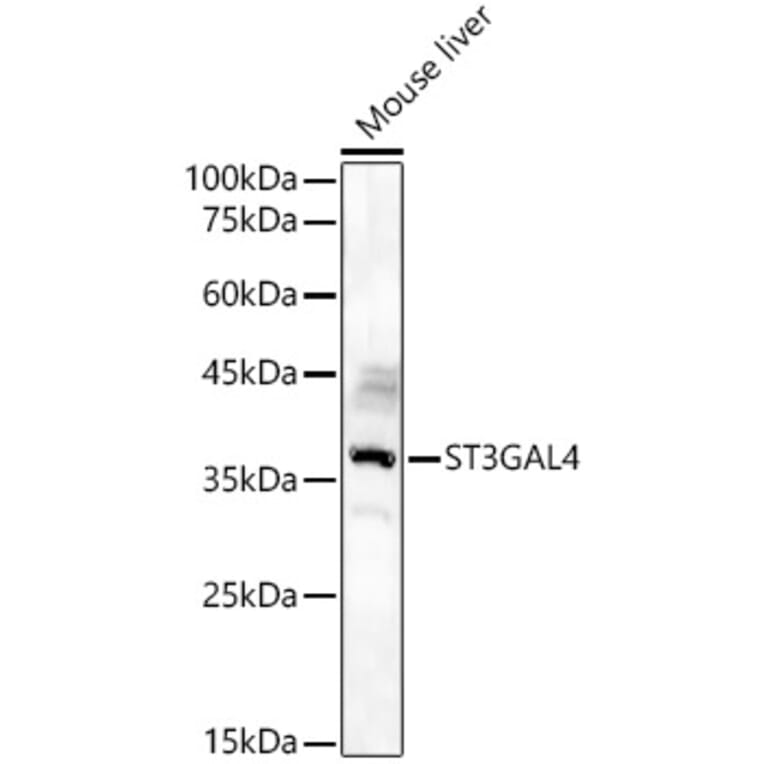 Western Blot - Anti-ST3GAL4 / STZ Antibody (A90064) - Antibodies.com