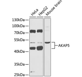Western Blot - Anti-AKAP5 Antibody (A90065) - Antibodies.com