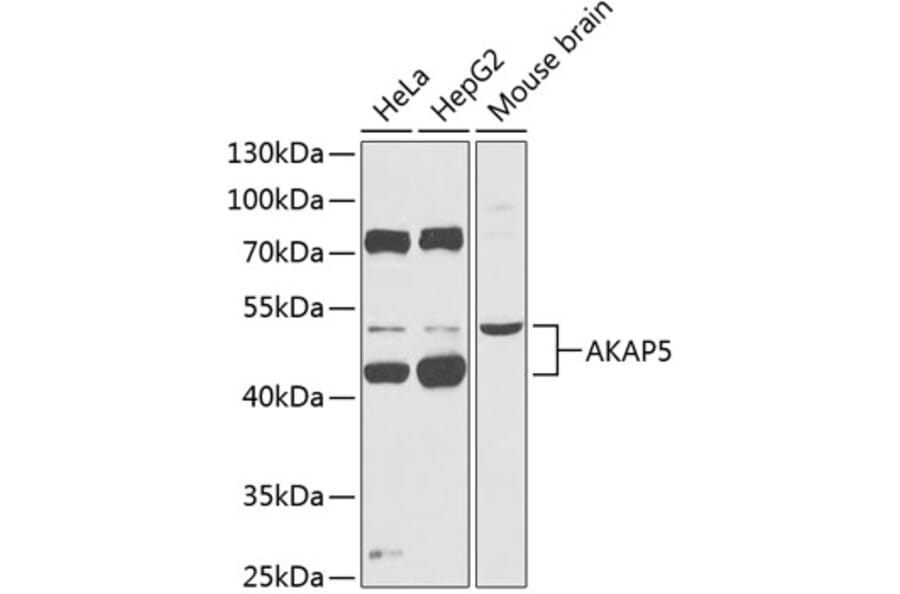 Western Blot - Anti-AKAP5 Antibody (A90065) - Antibodies.com