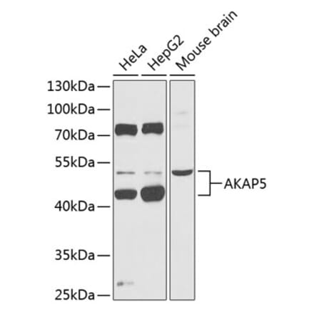 Western Blot - Anti-AKAP5 Antibody (A90065) - Antibodies.com