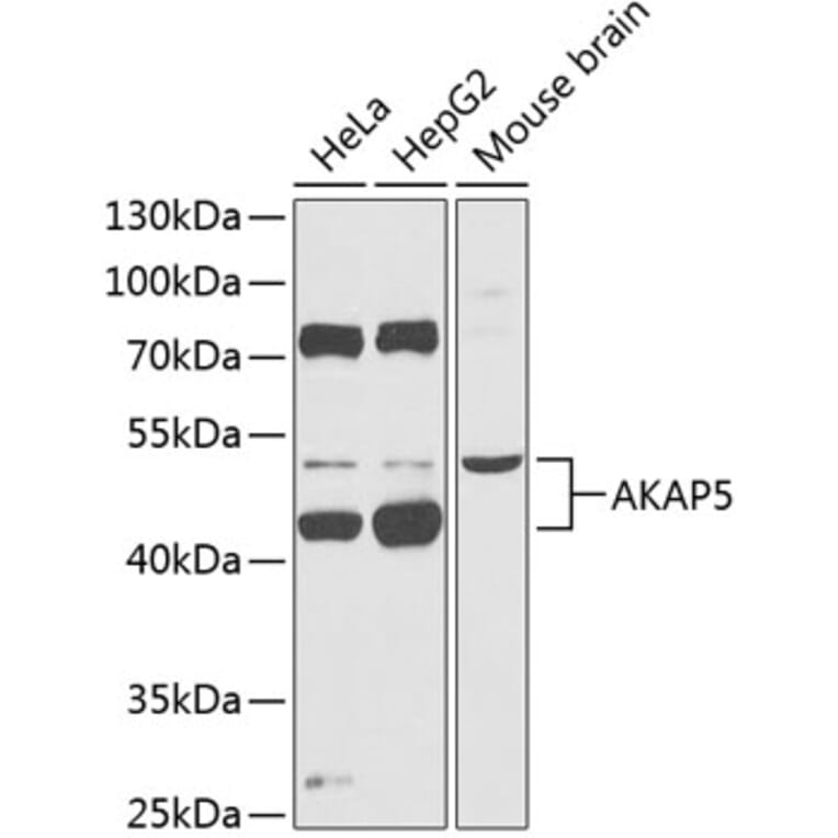 Western Blot - Anti-AKAP5 Antibody (A90065) - Antibodies.com