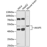 Western Blot - Anti-AKAP5 Antibody (A90065) - Antibodies.com