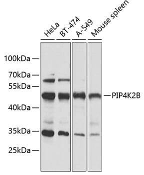 Western blot analysis of extracts of various cell lines, using Anti-PIP4K2B Antibody (A12535) at 1:1,000 dilution.
Secondary antibody: Goat Anti-Rabbit IgG (H+L) (HRP) (AS014) at 1:10,000 dilution.
Lysates / proteins: 25µg per lane.
Blocking buffer: 3% non-fat dry milk in TBST.
Detection: ECL Basic Kit (RM00020).
Exposure time: 30s.