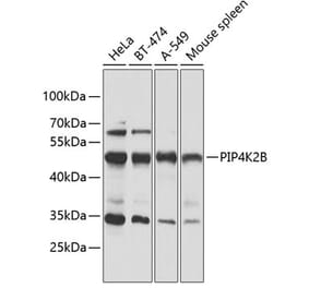 Western Blot - Anti-PIP4K2 beta Antibody (A90066) - Antibodies.com